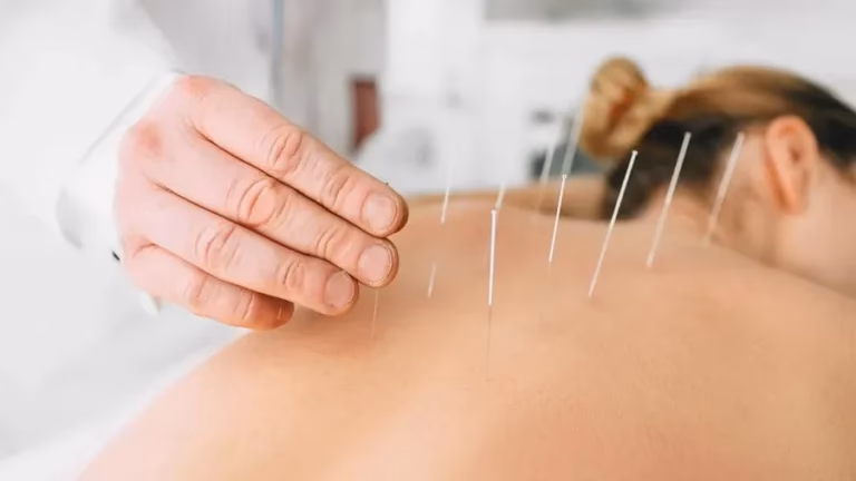 Quels sont les traitements d’acupuncture ?