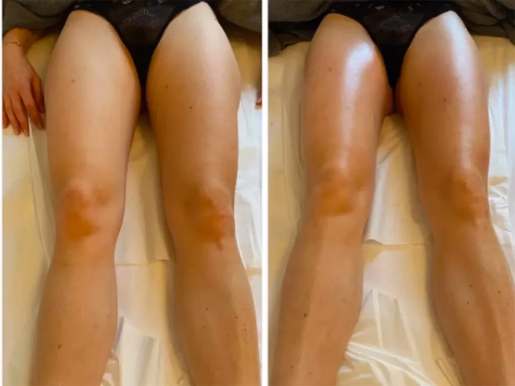 Quels sont les bienfaits de l’auto-massage ?