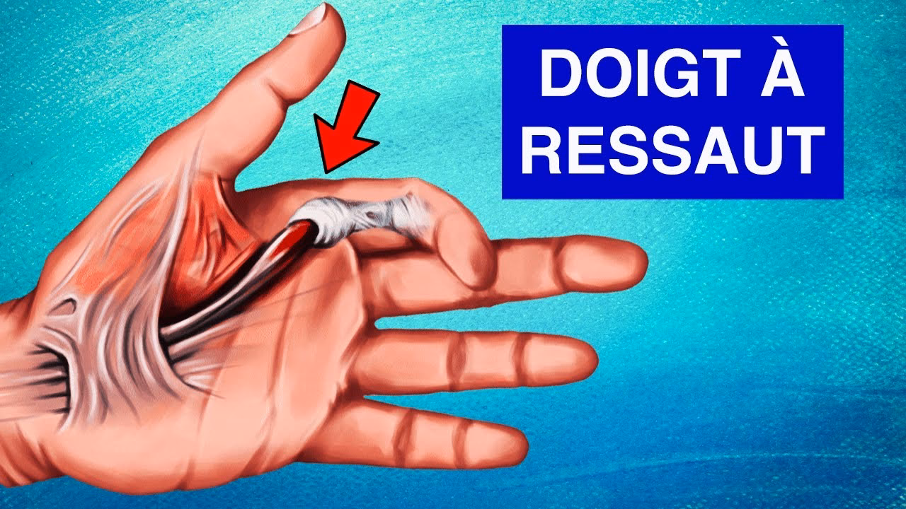 Quelle est la meilleure huile essentielle pour le doigt à ressaut ?