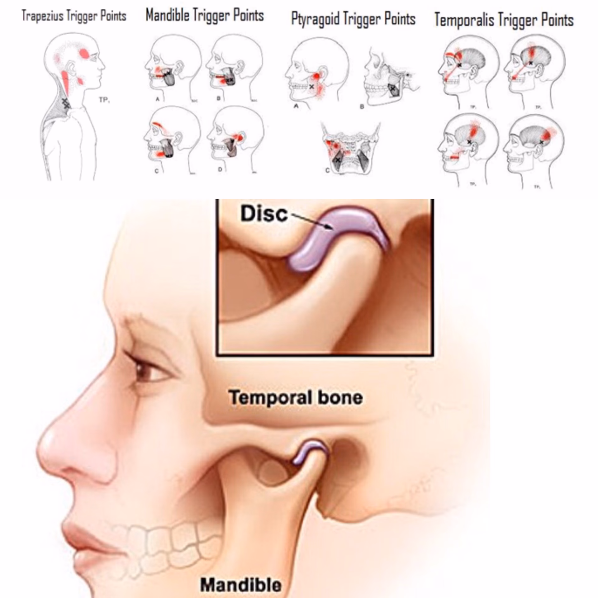 Does face yoga help TMJ?