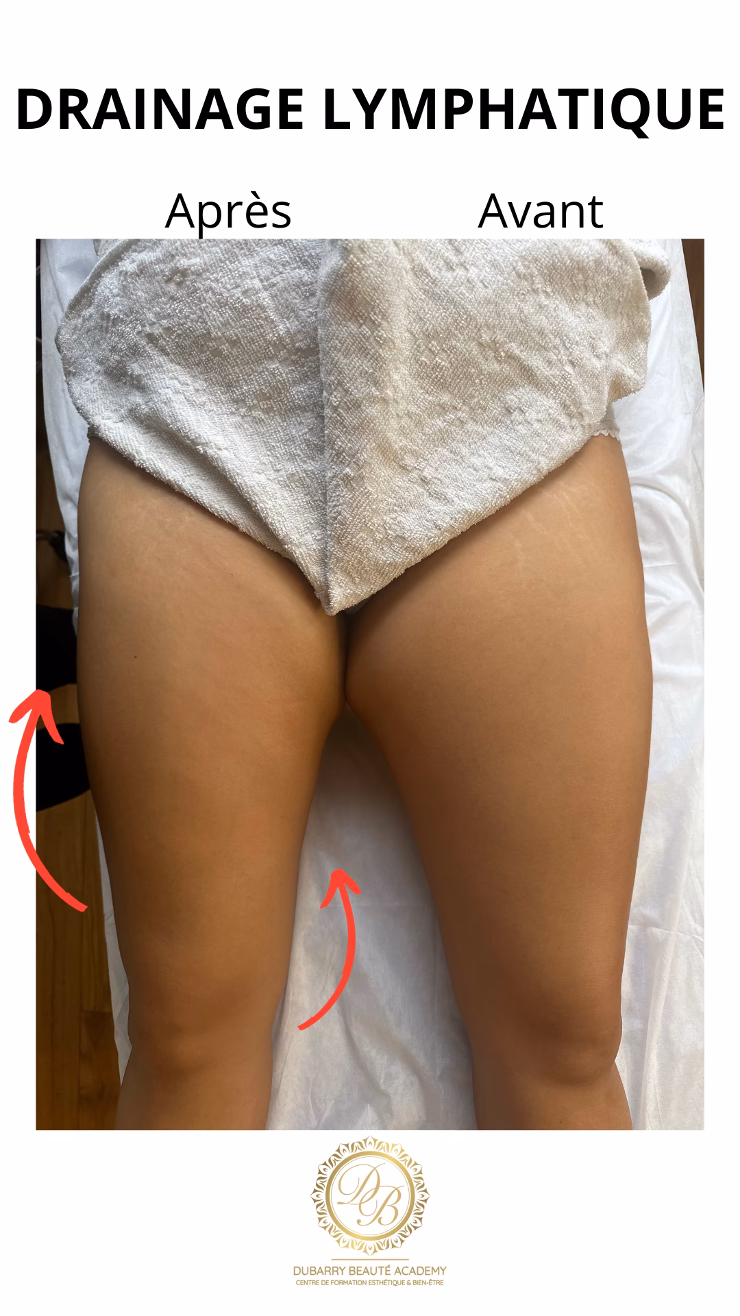 Quels sont les avantages d’un massage drainage lymphatique manuel ?