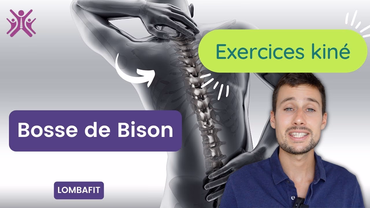 Quelle est la meilleure posture pour la bosse de bison ?