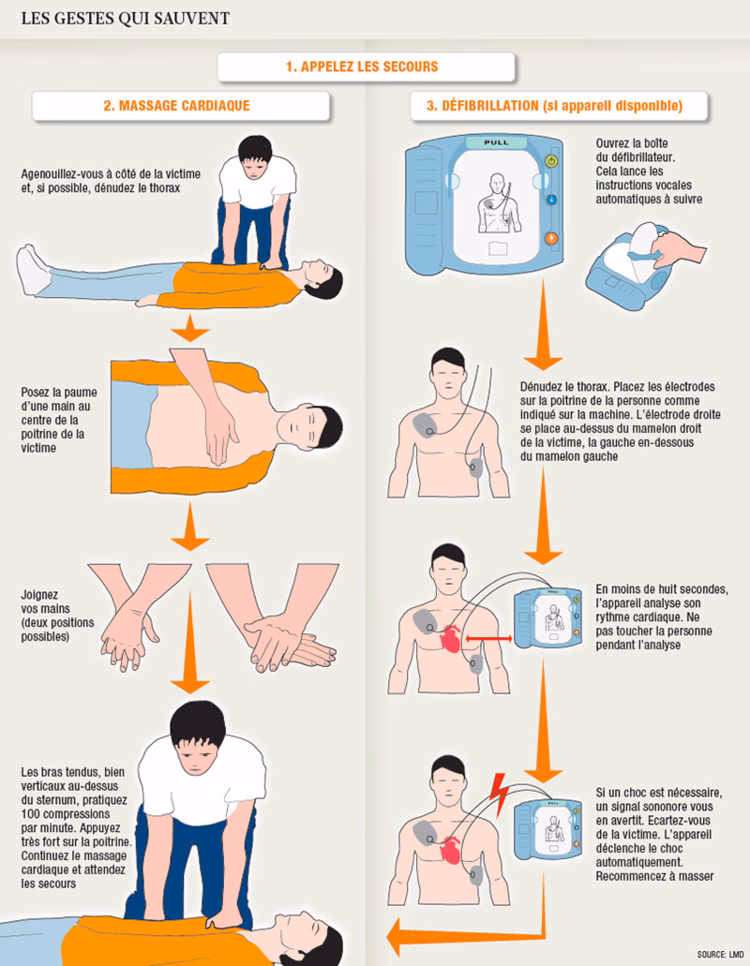 Quels sont les différents types de massage cardiaque ?
