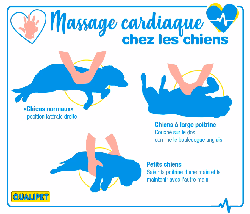 Comment faire un massage cardiaque en cas d'absence simultanée de respiration ?