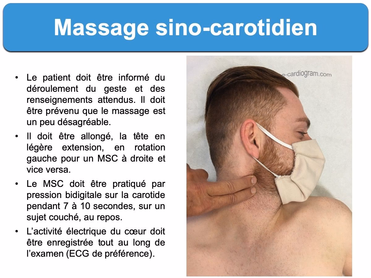Comment faire un massage à la carotide ?