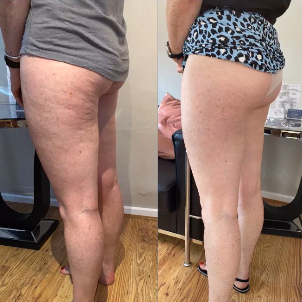 Quels sont les bienfaits du massage du visage ?