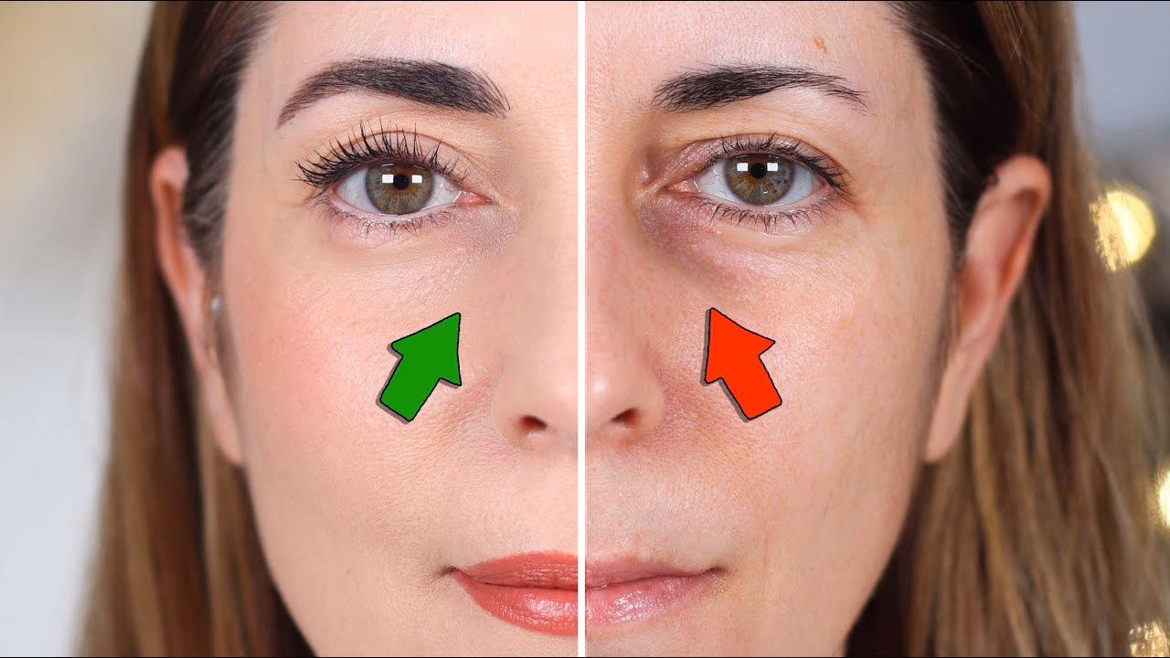 Comment se débarrasser des cernes sur les yeux ?