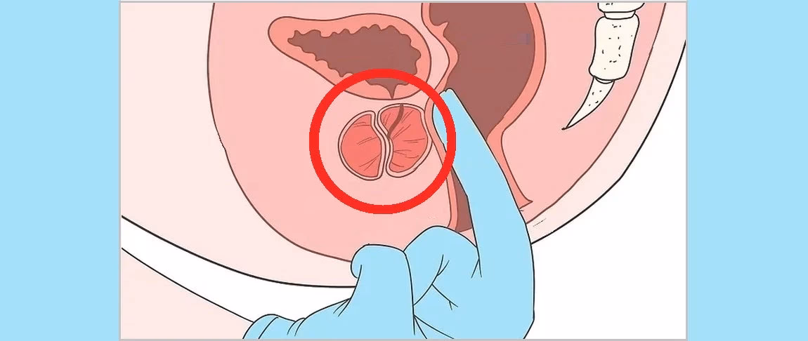 Comment trouver un massothérapeute qualifié pour le massage de la prostate ?