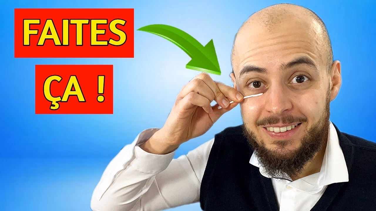 Comment traiter la blépharite ?