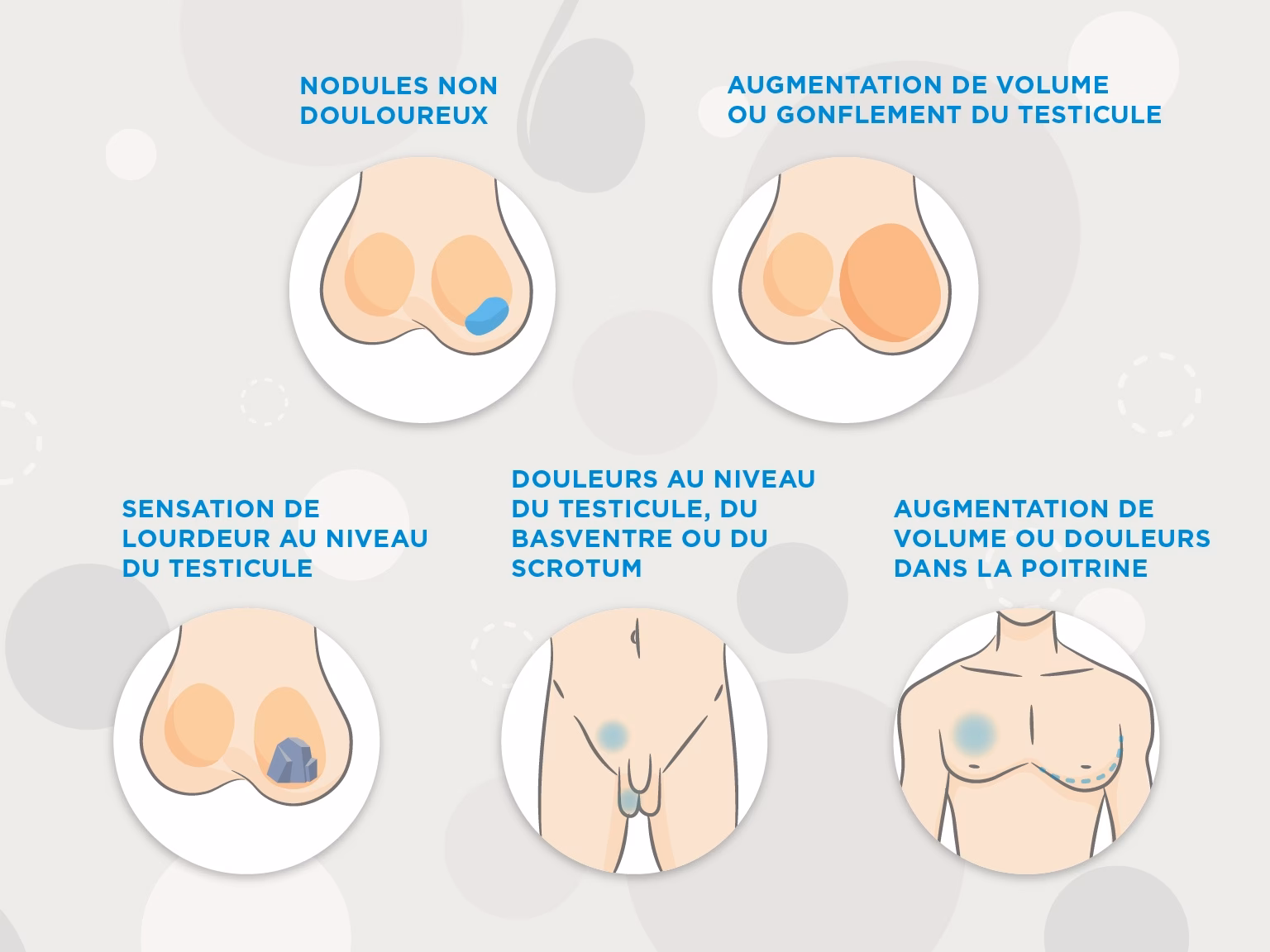 Quand faut-il éviter les massages testiculaires ?