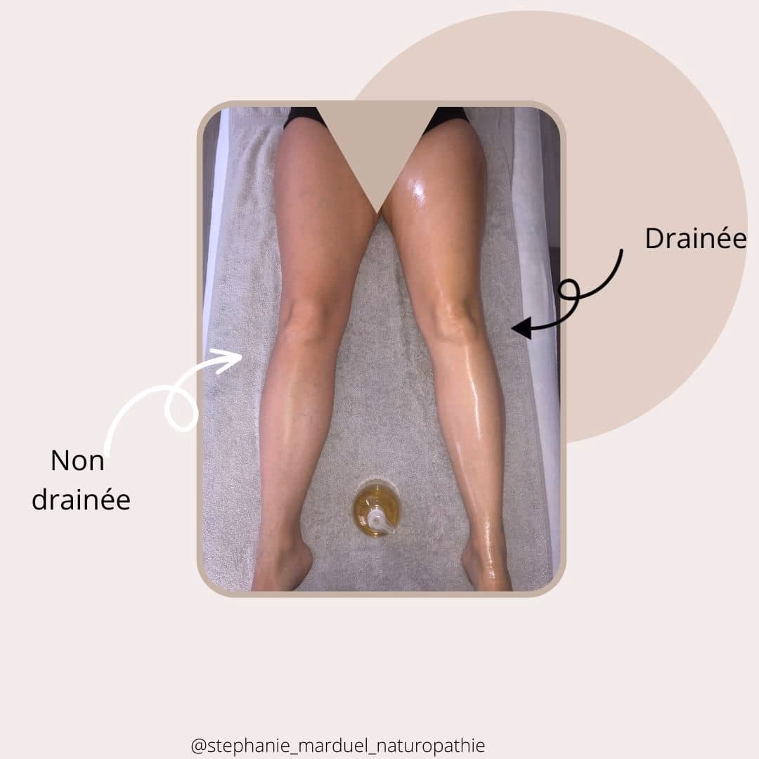 Quels sont les bienfaits du drainage lymphatique avant-après ?