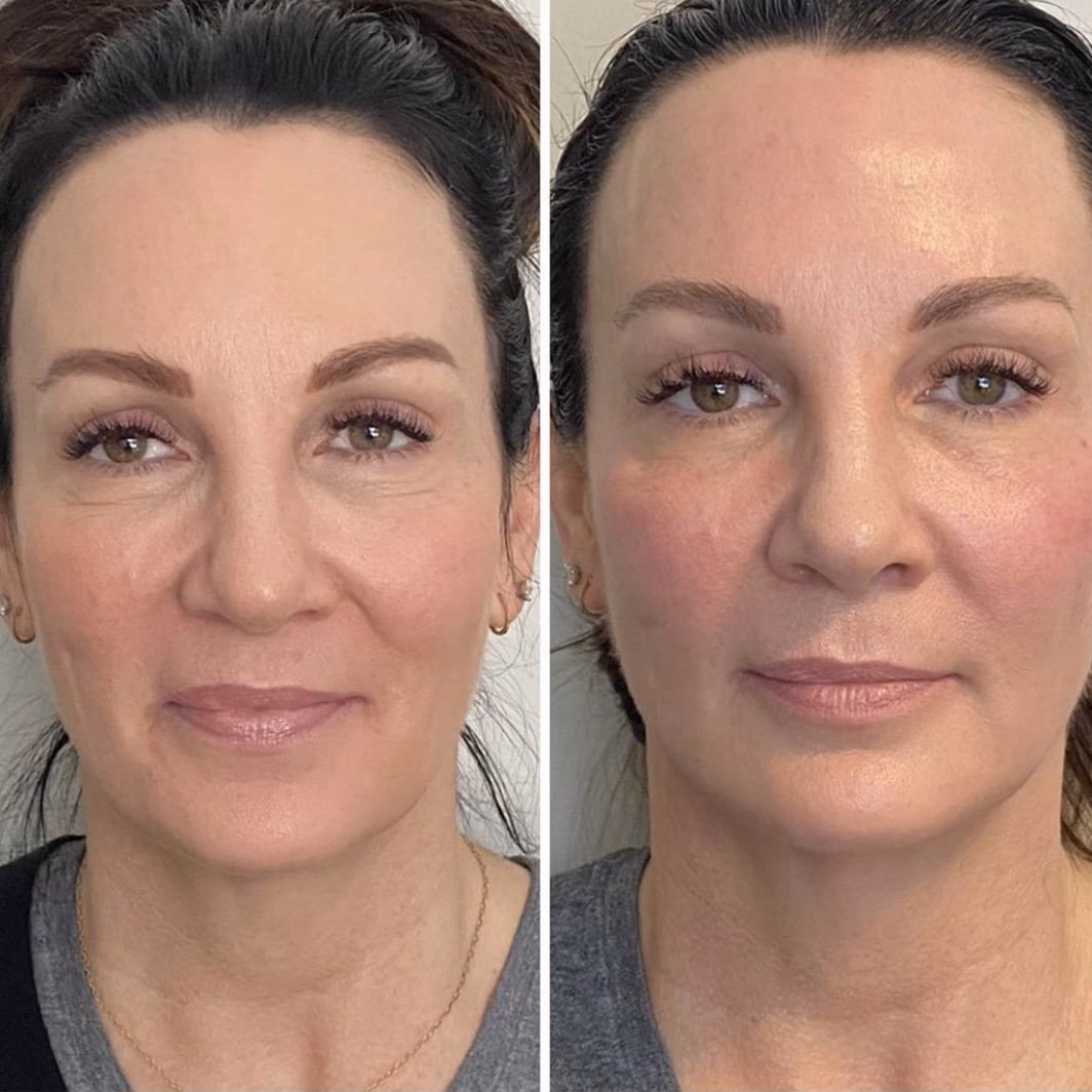 Pourquoi faire un massage à l’intérieur de la bouche ?