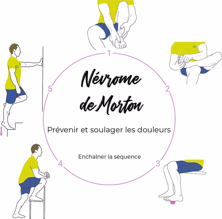 Comment traiter le syndrome de Morton ?
