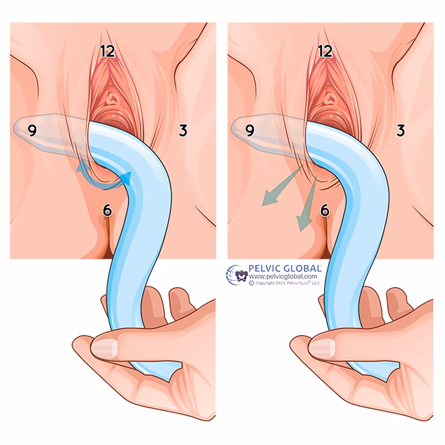 How to self-massage pelvic floor muscles?