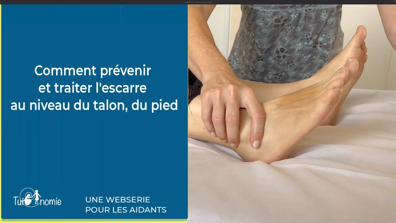 Comment guérir d'une escarre ?