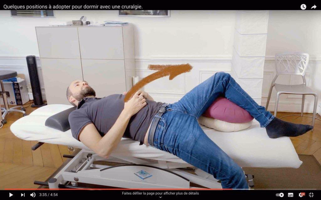 Comment soigner une cruralgie ?