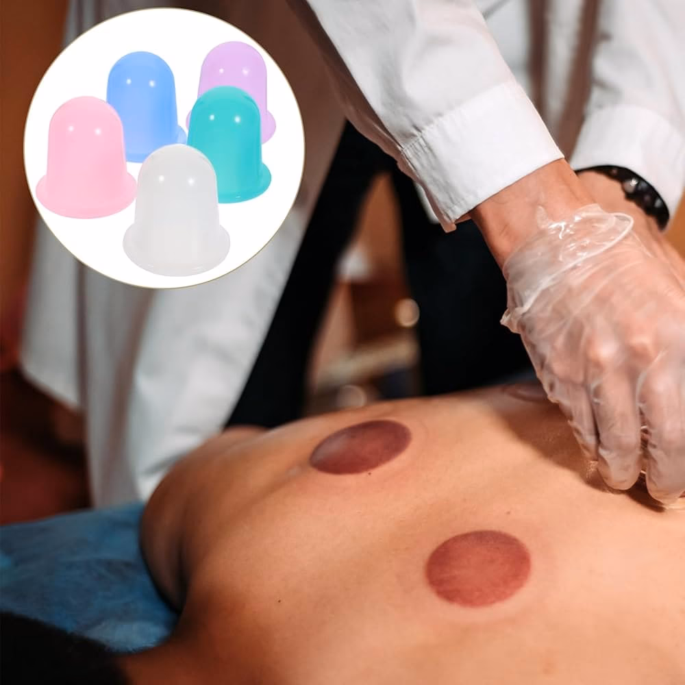 Quels sont les différents types de ventouses ?