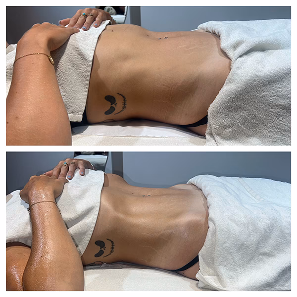 Quels sont les bienfaits de la méthode Renata Franca ?