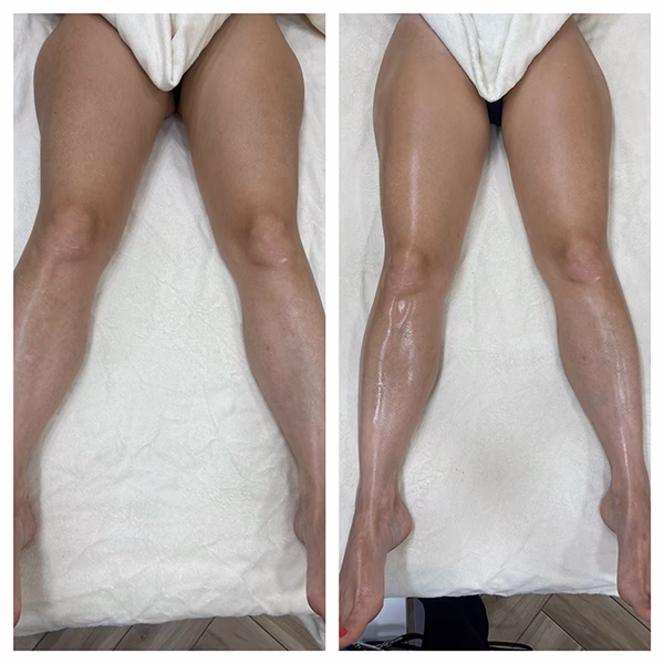 Quels sont les bienfaits de la méthode Renata Franca ?