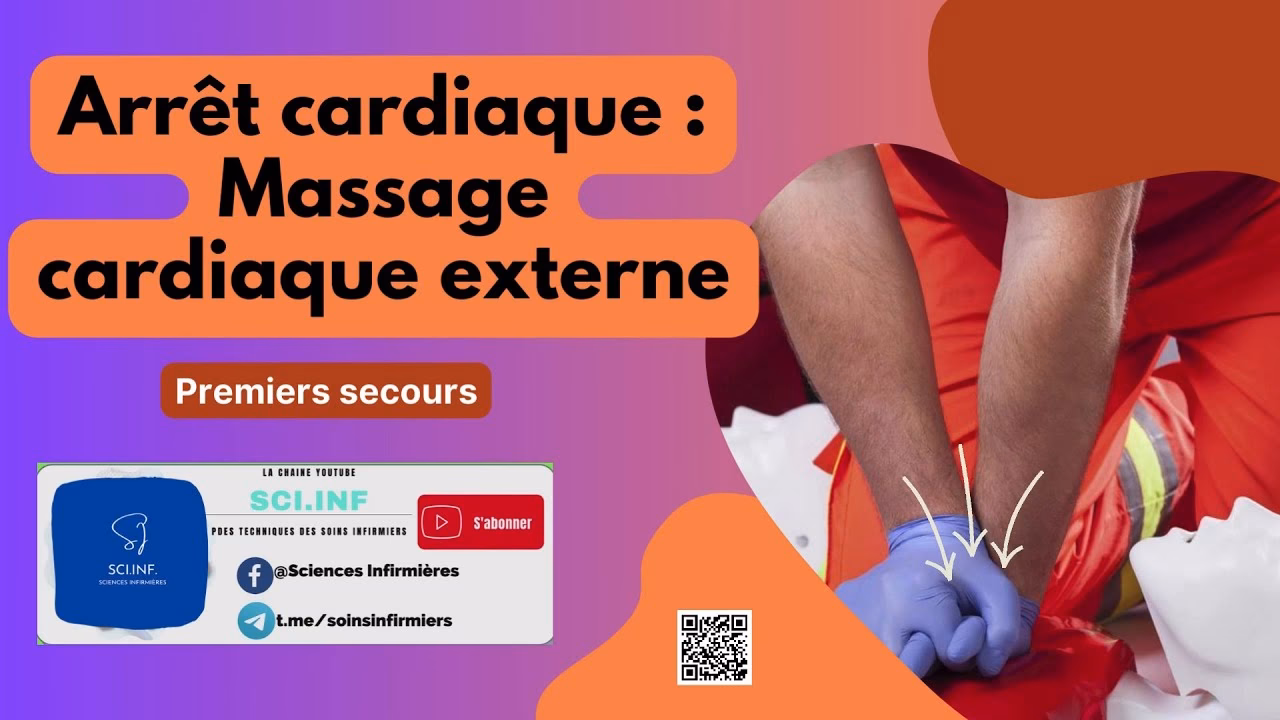 Quand faire un MCE ?