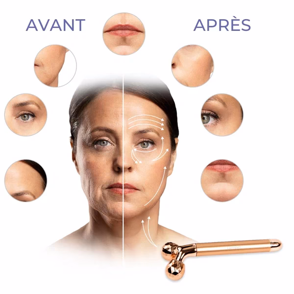 Pourquoi les rides du sourire touchent-elles les femmes ?