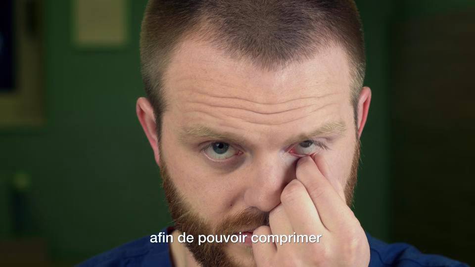 Comment traiter la rosacée oculaire ?